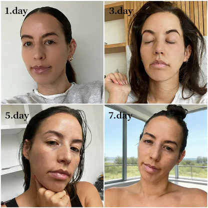 Purelora® EGF & Copper Peptide Revitalizing Essence Cream (Deeply activates skin renewal, helping visibly firm, smooth, and rejuvenate the skin)