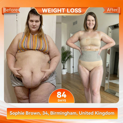 ✨LAST DAY SALE – 80% OFF✨BQODQO® 𝐌𝐨𝐫𝐢𝐧𝐠𝐚 & 𝐁𝐞𝐫𝐛𝐞𝐫𝐢𝐧𝐞 4‑In‑1 Micro‑Particle Sculpting & Fat‑Burn Shorts