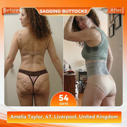 ✨LAST DAY SALE – 80% OFF✨BQODQO® 𝐌𝐨𝐫𝐢𝐧𝐠𝐚 & 𝐁𝐞𝐫𝐛𝐞𝐫𝐢𝐧𝐞 4‑In‑1 Micro‑Particle Sculpting & Fat‑Burn Shorts