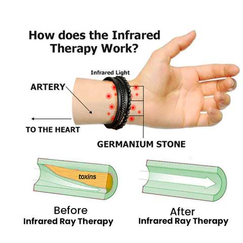 (🔥LAST DAY SALE-80% OFF)  Histone Germanium Lymphvity Detox Bracelet