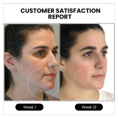 (✨ LAST DAY SALE-80% OFF) 💎Czticle® Histone Magnetology Lymphvity Germanium Earrings